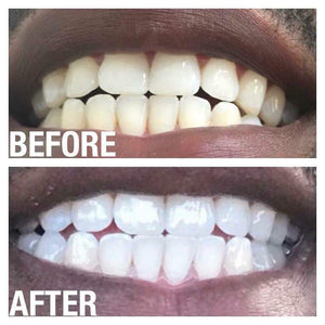 Whitener Toothpaste Ap24