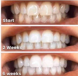 Whitener Toothpaste Ap24